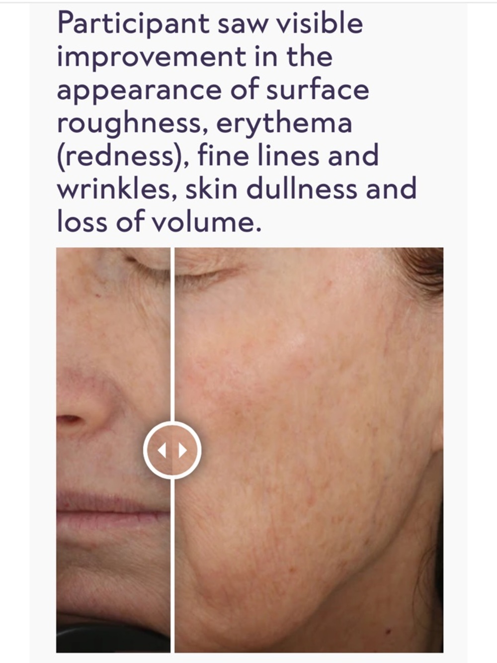 Alastin Restorative Skin Complex - Picture 12 of 13